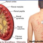 Early Signs of Kidney Disease & How to Protect Your Kidneys (Evidence Based)