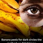 🍌 Banana Peel for Dark Circles: I Tried It—And Here’s What Really Happened