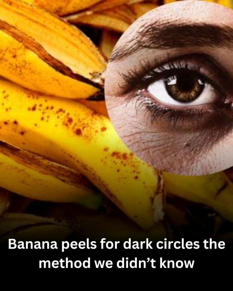 🍌 Banana Peel for Dark Circles: I Tried It—And Here’s What Really Happened