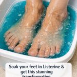Soak your feet in Listerine & get this stunning transformation
