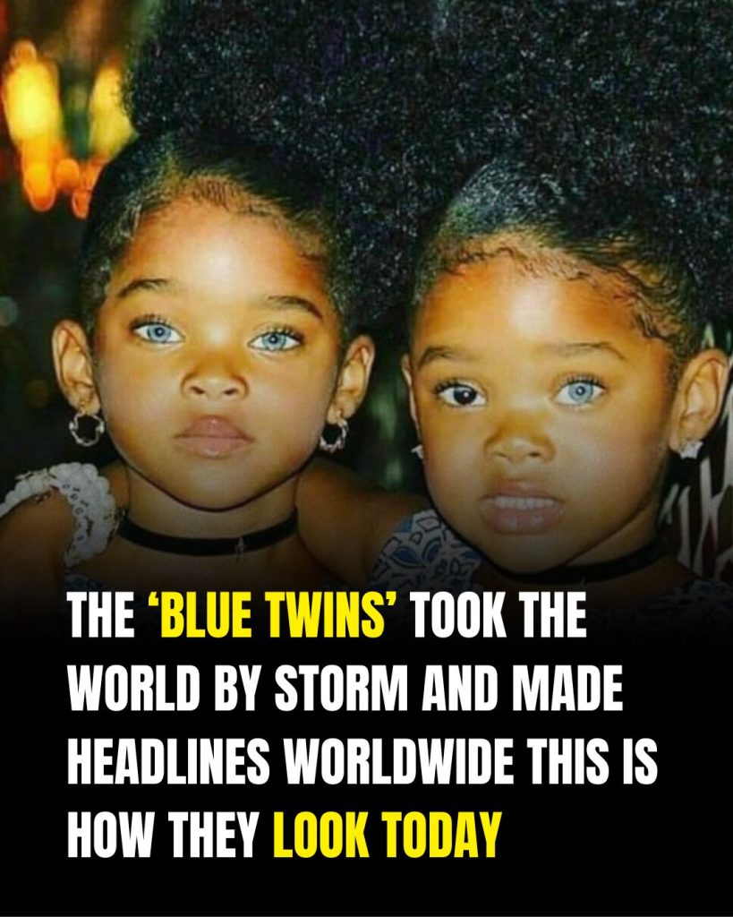 Meet the “Trueblue Twins” who now have a massive following
