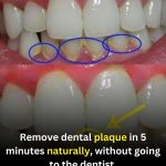 How to Reduce Dental Plaque Naturally at Home