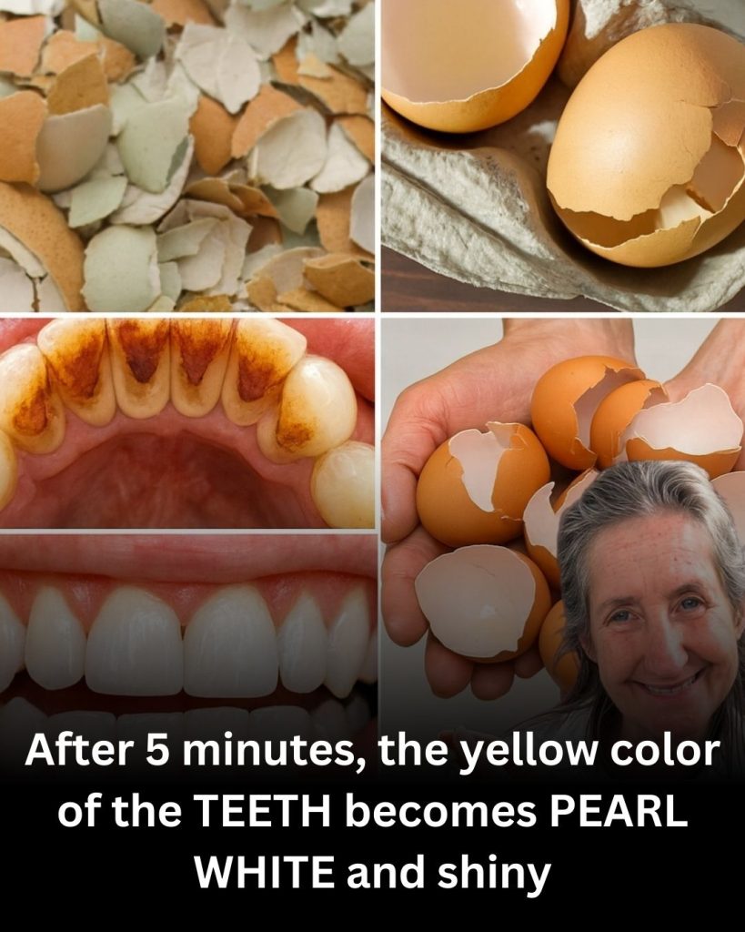 In Just 5 Minutes, Yellow Teeth Can Look Pearl White Naturally