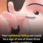 Eyelash Loss: When It’s Normal and When to Consider a Health Check