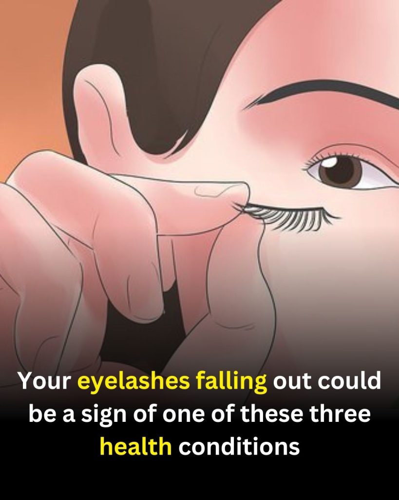 Eyelash Loss: When It’s Normal and When to Consider a Health Check