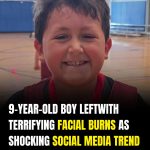 9-year-old boy left with terrifying facial burns as shocking social media trend emerges