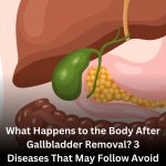 Life After Gallbladder Removal: Honoring Your Body’s Quiet Wisdom
