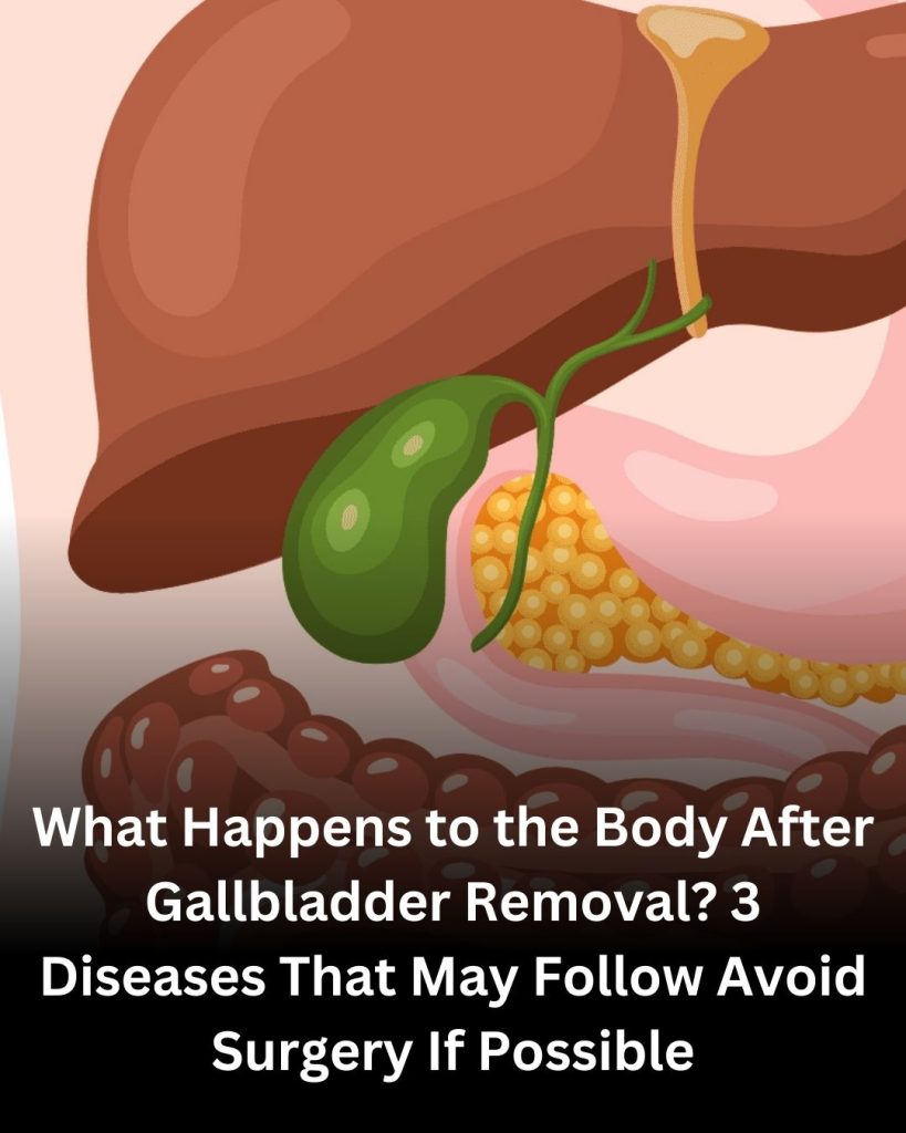 Life After Gallbladder Removal: Honoring Your Body’s Quiet Wisdom