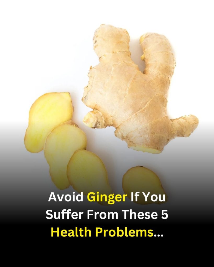 Ginger Isn’t for Everyone: 5 Situations Where Caution May Help