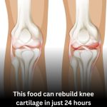 97-year-old orthopedic surgeon claims: This food can rebuild knee cartilage in just 24 hours