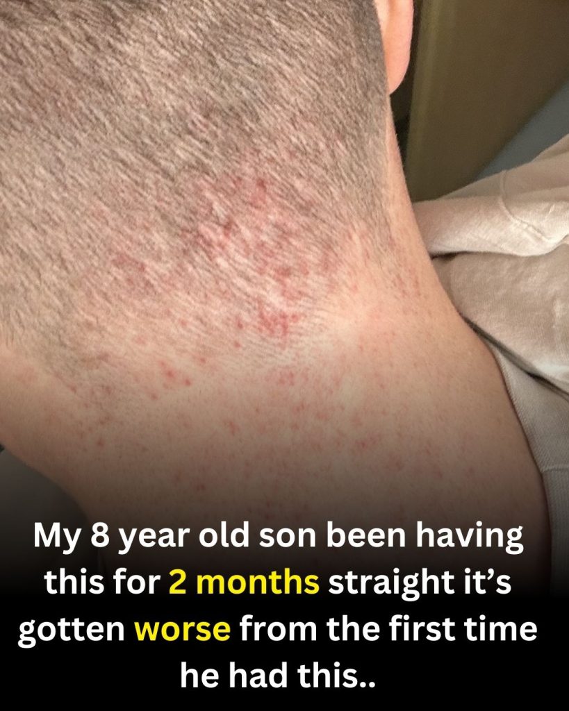 Child Experiencing Ongoing Itchy Skin? Understanding Hives (Urticaria) and When to Seek Care