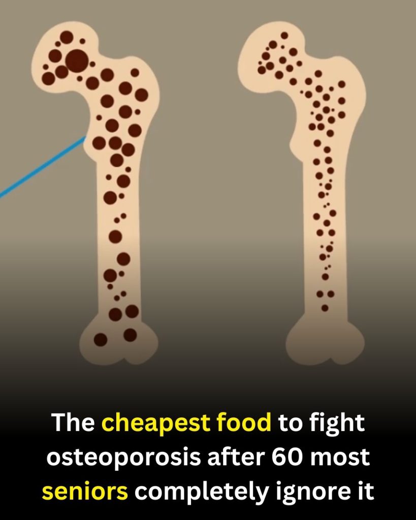 A Budget-Friendly Food That Supports Bone Health After 60 (Many People Overlook It)