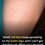 Small Red Dots on the Lower Legs: Possible Causes and Safe Steps to Take While You Wait for Care