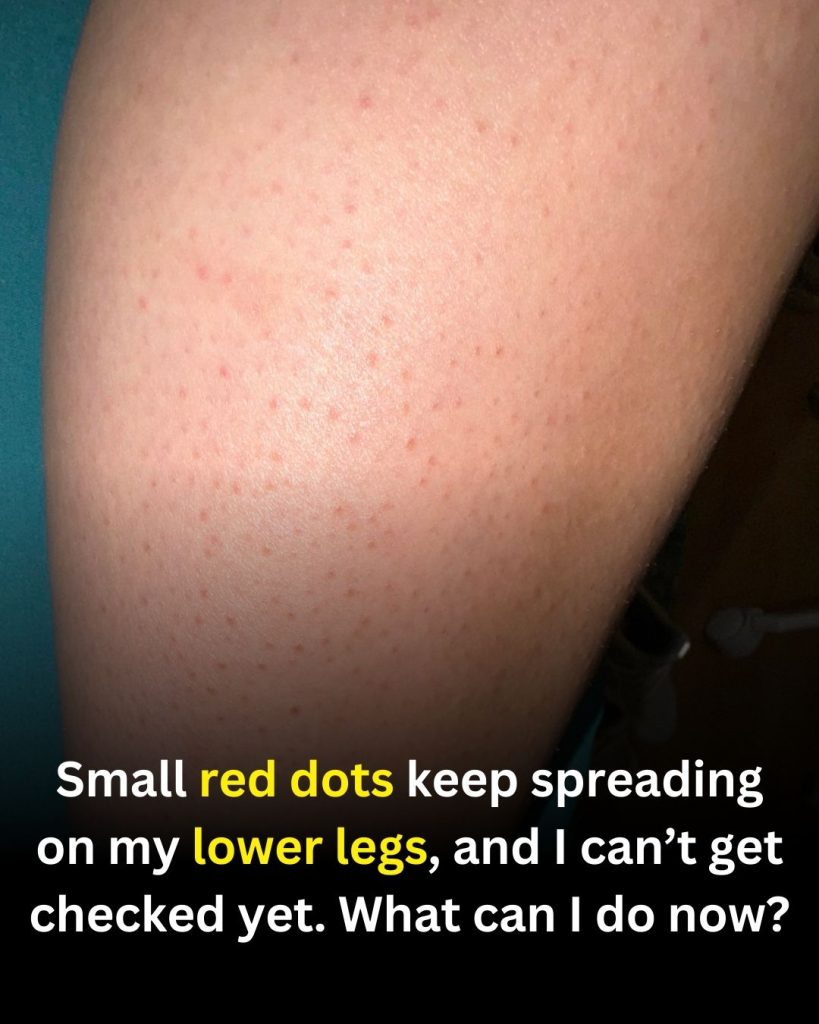 Small Red Dots on the Lower Legs: Possible Causes and Safe Steps to Take While You Wait for Care