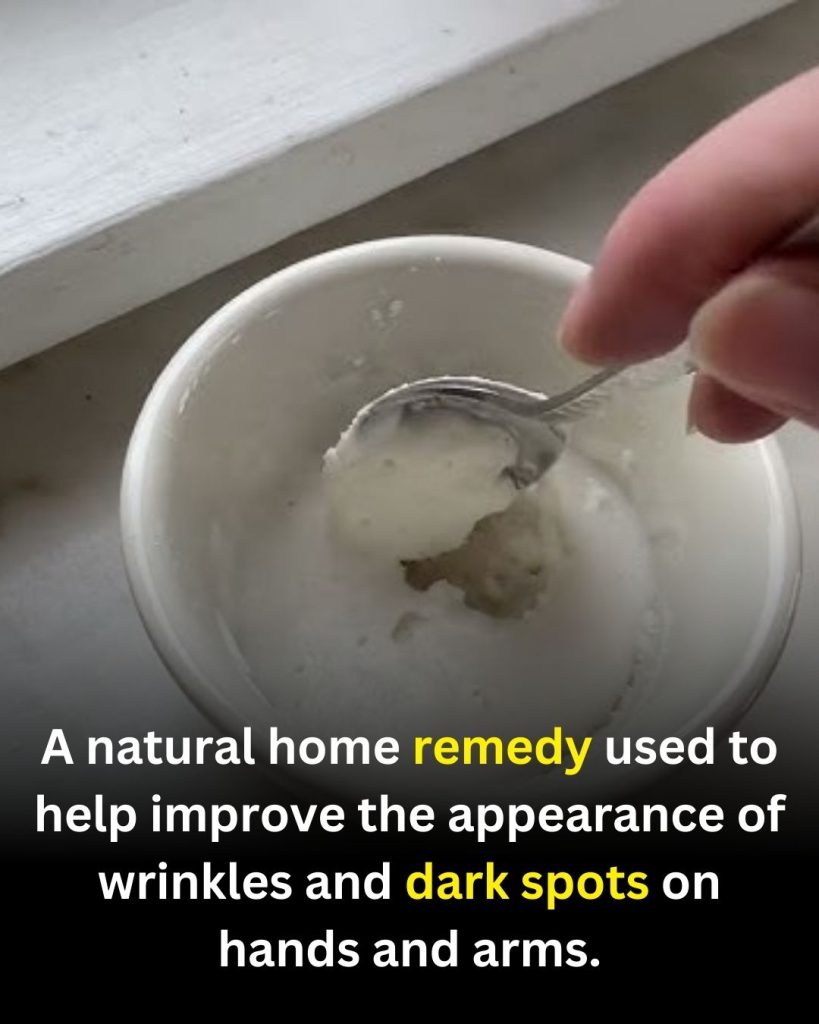 A Gentle At-Home Routine People Use to Improve the Look of Wrinkles and Dark Spots on Hands and Arms