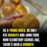 Child Suffers Permanent Vision Loss Linked to Severe Vitamin A Deficiency, Doctors Warn