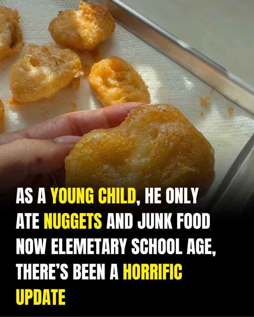 Child Suffers Permanent Vision Loss Linked to Severe Vitamin A Deficiency, Doctors Warn