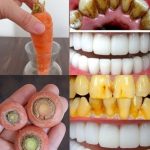 Whiten Teeth Like Pearls in 2 Minutes? Here’s the Truth About This Carrot Top Remedy