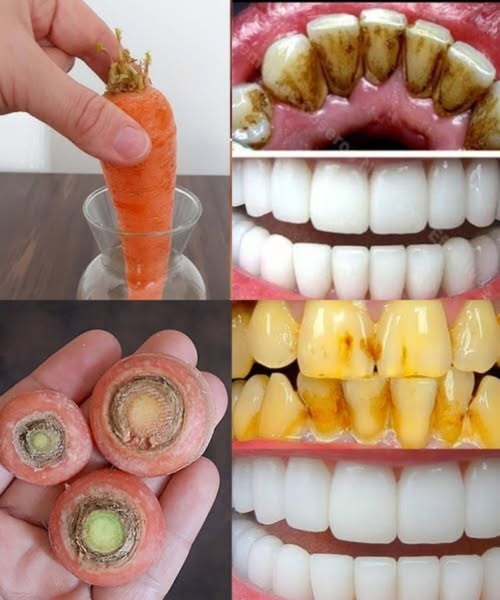 Whiten Teeth Like Pearls in 2 Minutes? Here’s the Truth About This Carrot Top Remedy