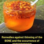 Osteoporosis Is Not Something to Ignore — But Proper Nutrition Can Help Support Your Bones