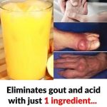 Can One Natural Ingredient Help With Gout and Uric Acid? Here’s What to Know
