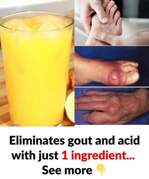 Can One Natural Ingredient Help With Gout and Uric Acid? Here’s What to Know