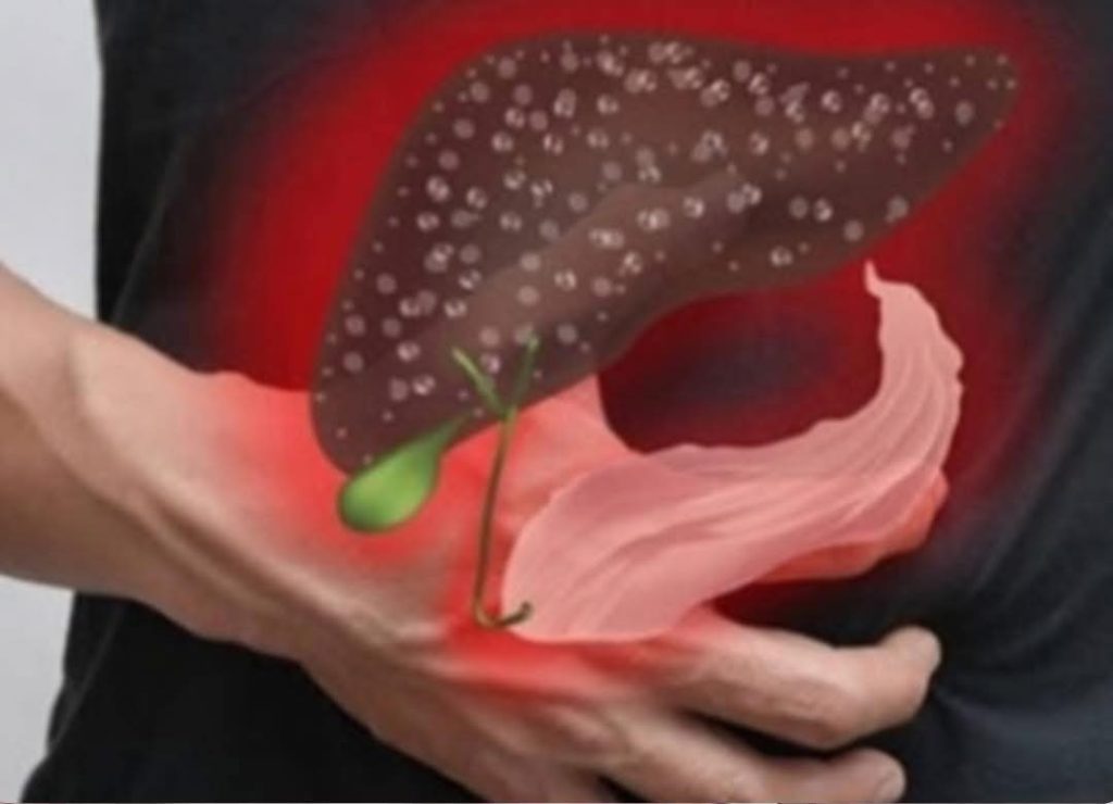 These are 6 signs that show your liver is overloaded with toxins