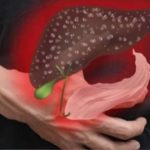 These are 6 signs that show your liver is overloaded with toxins