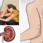 These Are 3 Main Signs You Should Not Ignore That May Show Kidney Problems Have Started