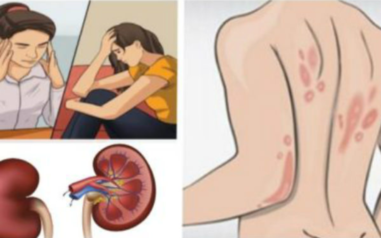 These Are 3 Main Signs You Should Not Ignore That May Show Kidney Problems Have Started