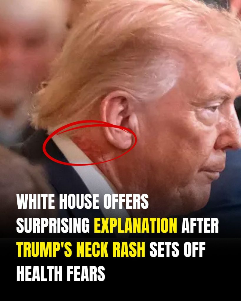 Scabbing neck rash fuels new health speculation around Donald Trump