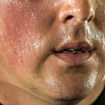Waking Up Sweating at Night? 5 Things You Should Not Ignore