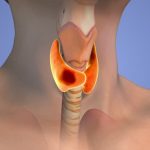 A 1-Week Diet Plan for People With Thyroid Problems in the Early Stage of Treatment