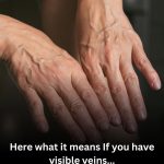 If you have visible veins, it means you are…