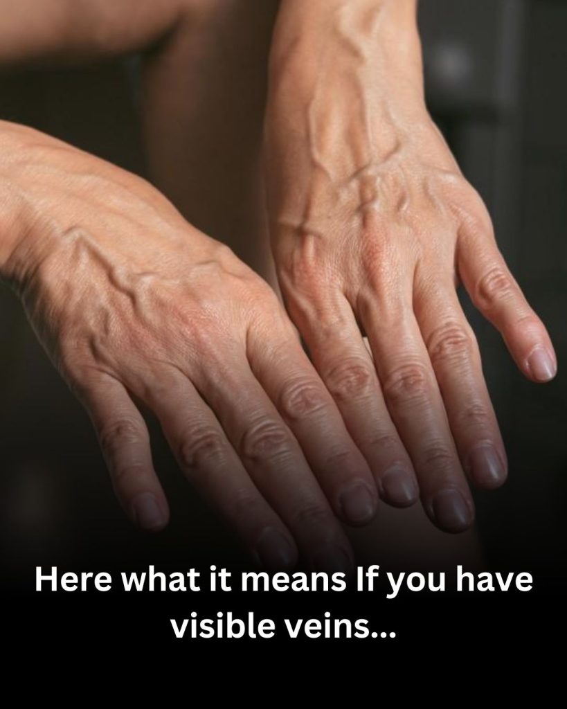 If you have visible veins, it means you are…