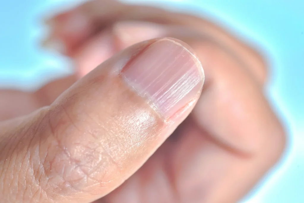 What Lines and Changes on Your Nails May Reveal About Your Health