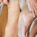 This Could Be One of the Main Visible Signs of High Cholesterol