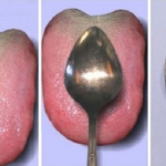 What Your Tongue May Reveal About Your Health
