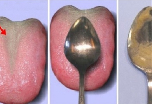 What Your Tongue May Reveal About Your Health