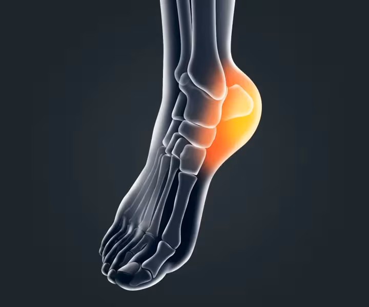 7 Effective Exercises to Help Relieve Heel Pain and Plantar Fasciitis Naturally