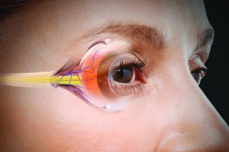6 of the Best Foods for Eye Health You Should Add to Your Diet