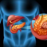 Spanish Study Brings New Hope for Pancreatic Cancer Research